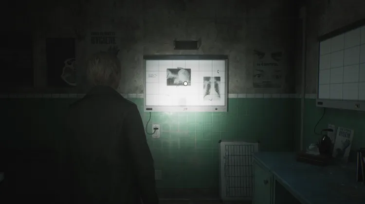 Écran de radiographie